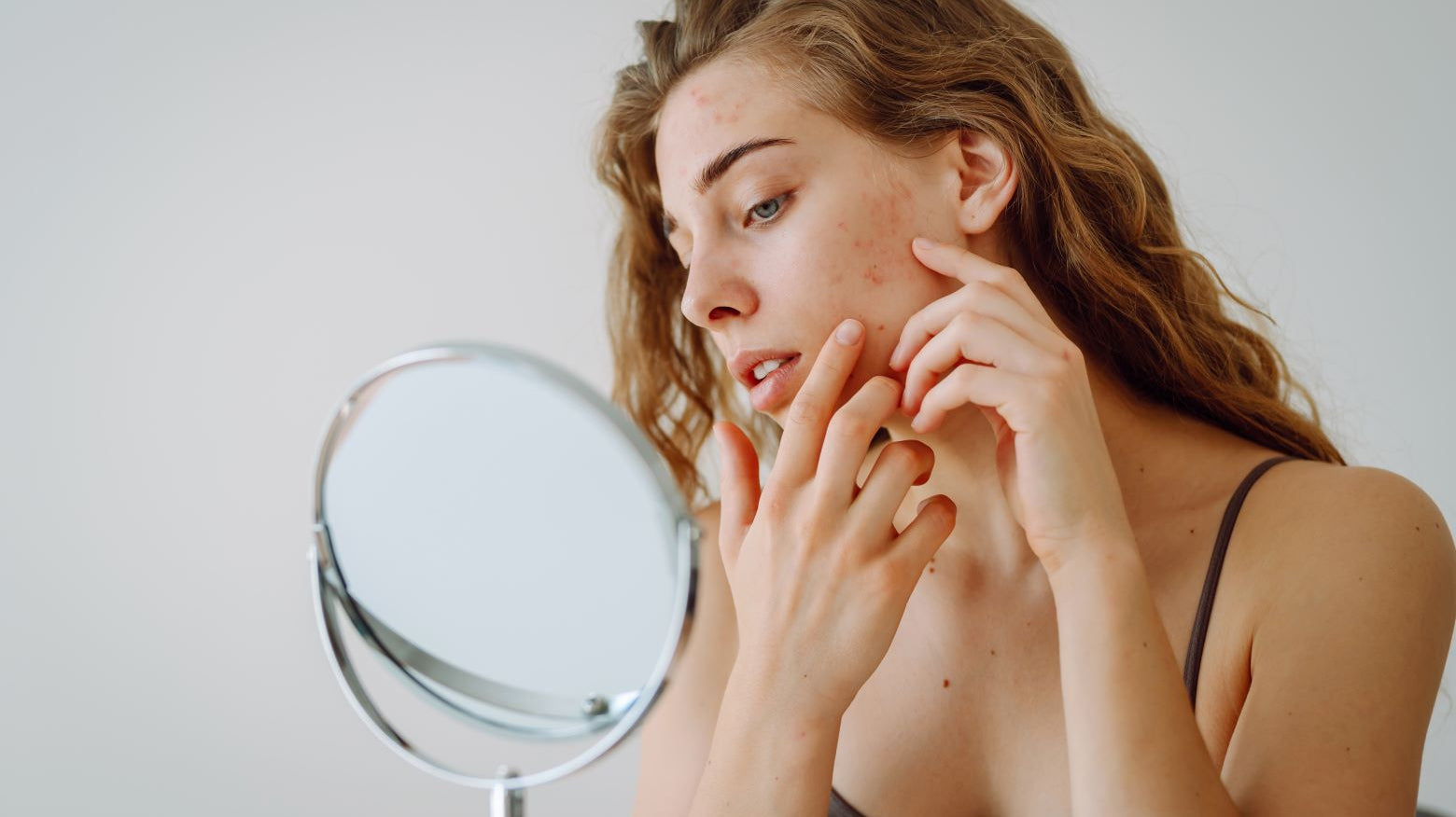 Onzuiverheden na je 30ste? Dit is waarom – en wat je eraan doet