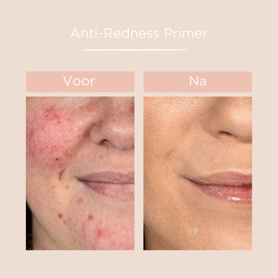Voor en na resultaat met Cent Pur Cent Anti-Redness Primer – vermindert roodheid en egaliseert de teint